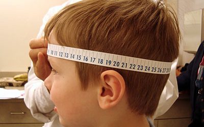 Macrocefalia – ce este si cand trebuie sa ne prezentam la medic