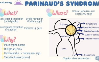 Sindromul Parinaud